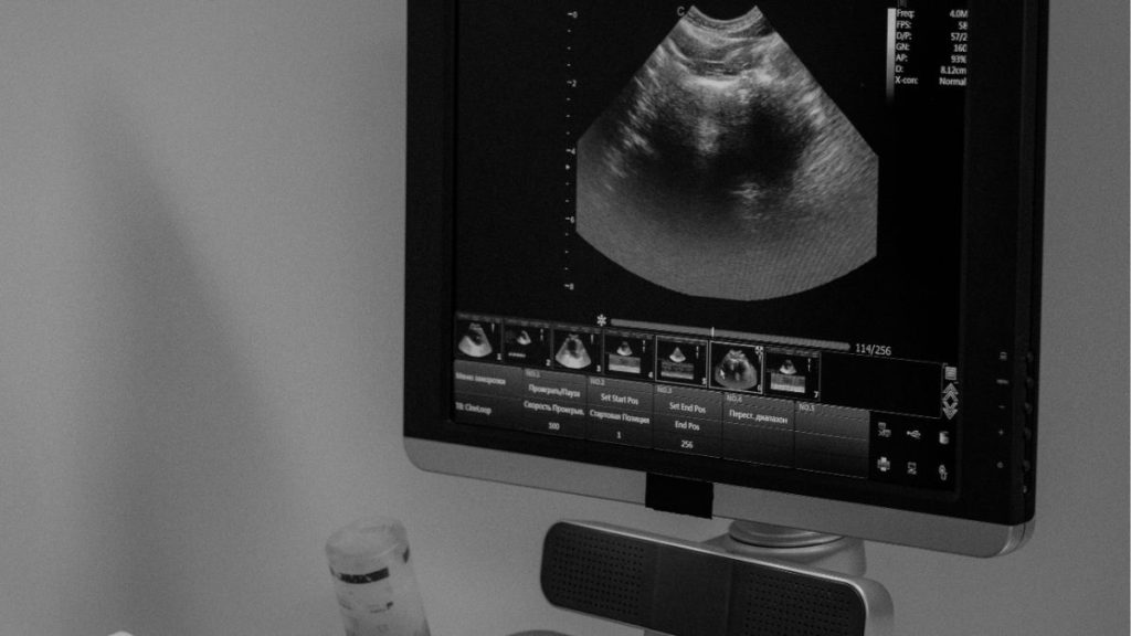 Thuê máy siêu âm xách tay ở Hà Nội: Giải pháp tiết kiệm và hiệu quả Thuê máy siêu âm xách tay ở Hà Nội