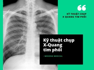 kỹ thuật chụp x-quang tim phổi