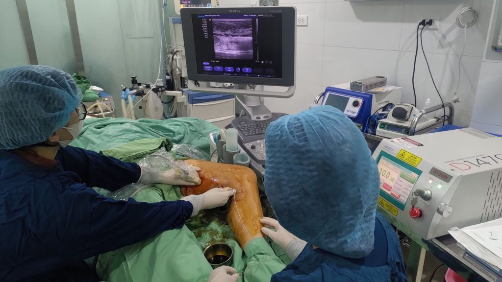 hỏi đáp về máy đốt sóng cao tần RFA